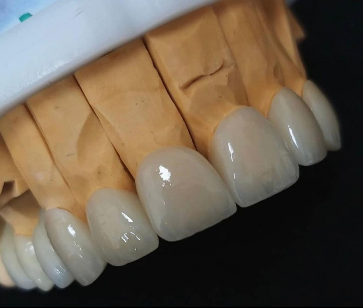 Laboratorio de Protese Dentaria